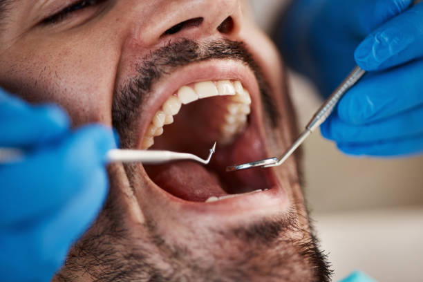 Best Emergency TMJ Treatment in Fairmount Heights, MD